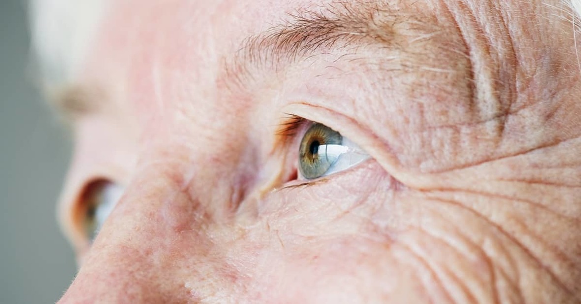 Cómo proteger la piel de las personas de la tercera edad